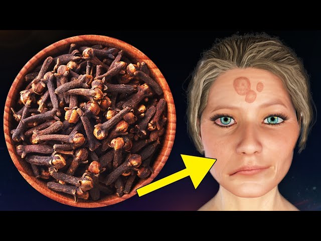 Avoid cloves If You Have These Health Issues | Cloves Side Effects - YouTube