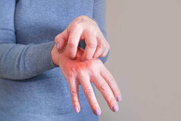Doctors explain infectious symptoms 'that take weeks to appear' |  Express.co.uk