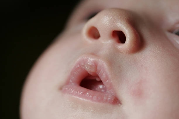 babys-mouth-and-nose-1