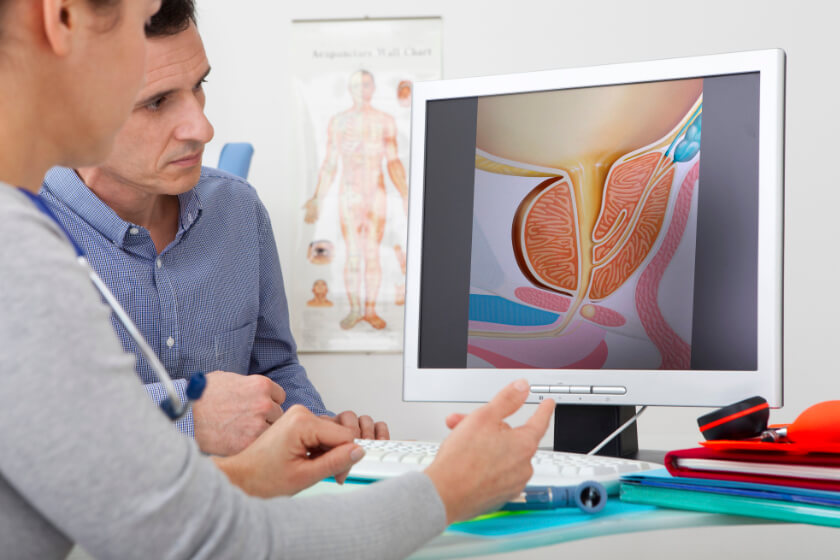Early Warning Signs for Prostate Cancer - RAI